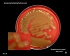streptococcus equi biovar equi